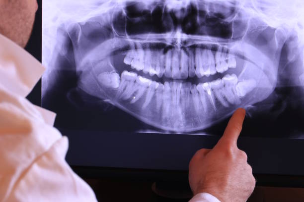 Best Emergency Treatment for Oral Infections in Waverly, TN