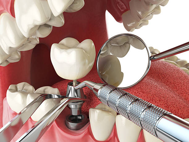 Best Emergency Denture Repair in Waverly, TN